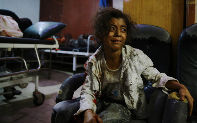 A wounded Syrian girl cries at a make-shift hospital in the rebel-held area of Douma, east of the capital Damascus, following reported air strikes by regime forces, on August 12, 2015. At least 27 civilians were killed in Syrian government air strikes on the Eastern Ghouta region near Damascus according to a monitoring group. AFP PHOTO / ABD DOUMANY