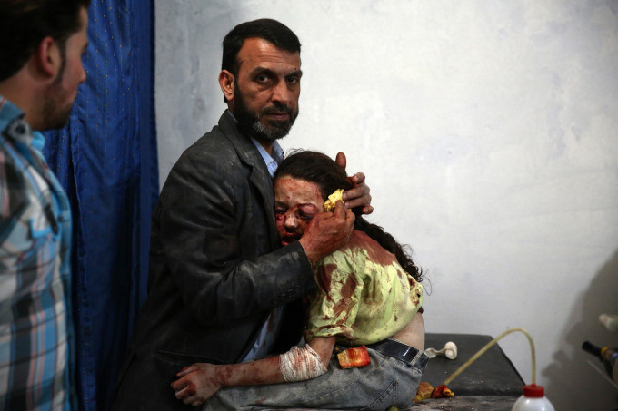 A wounded Syrian girl hold on to a relative as she awaits treatment by doctors at a makeshift hospital in the rebel-held area of Douma, east of the capital Damascus, following reported air strikes on the city on May 11, 2015. AFP PHOTO / ABD DOUMANY