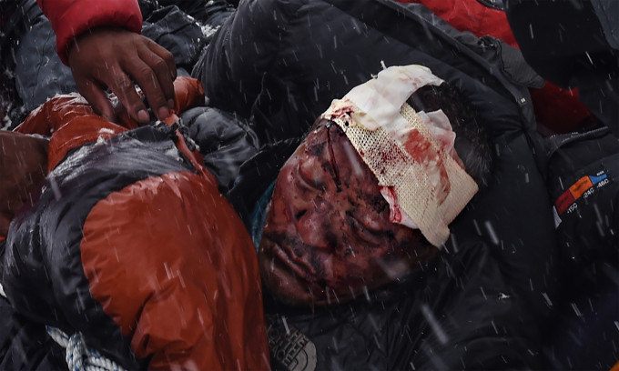 A man who suffered head trauma is bundled in a sleeping bag used as a makeshift stretcher as he was being taken by rescuers to a medical tent moments after a wall of rock, snow and debris slammed on Everest base camp on April 25, 2015 killing at least 22 people. The avalanche was triggered by a powerful 7.8-magnitude earthquake that killed more than 8,000 people in the country. Rescue helicopters managed to reach the site about 18 hours after the avalanche as bad weather, aftershocks and fears of further avalanches rattled survivors. At the time of the disaster, the 5,364-meter-high Base Camp was teeming with hundreds of climbers and supporting teams who use the base to prepare their ascent to the peak of Mount Everest, the tallest mountain on Earth.