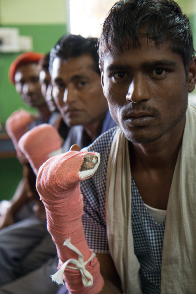 Four men recovering from reconstructive surgery for 'claw hand', a common disability caused by leprosy