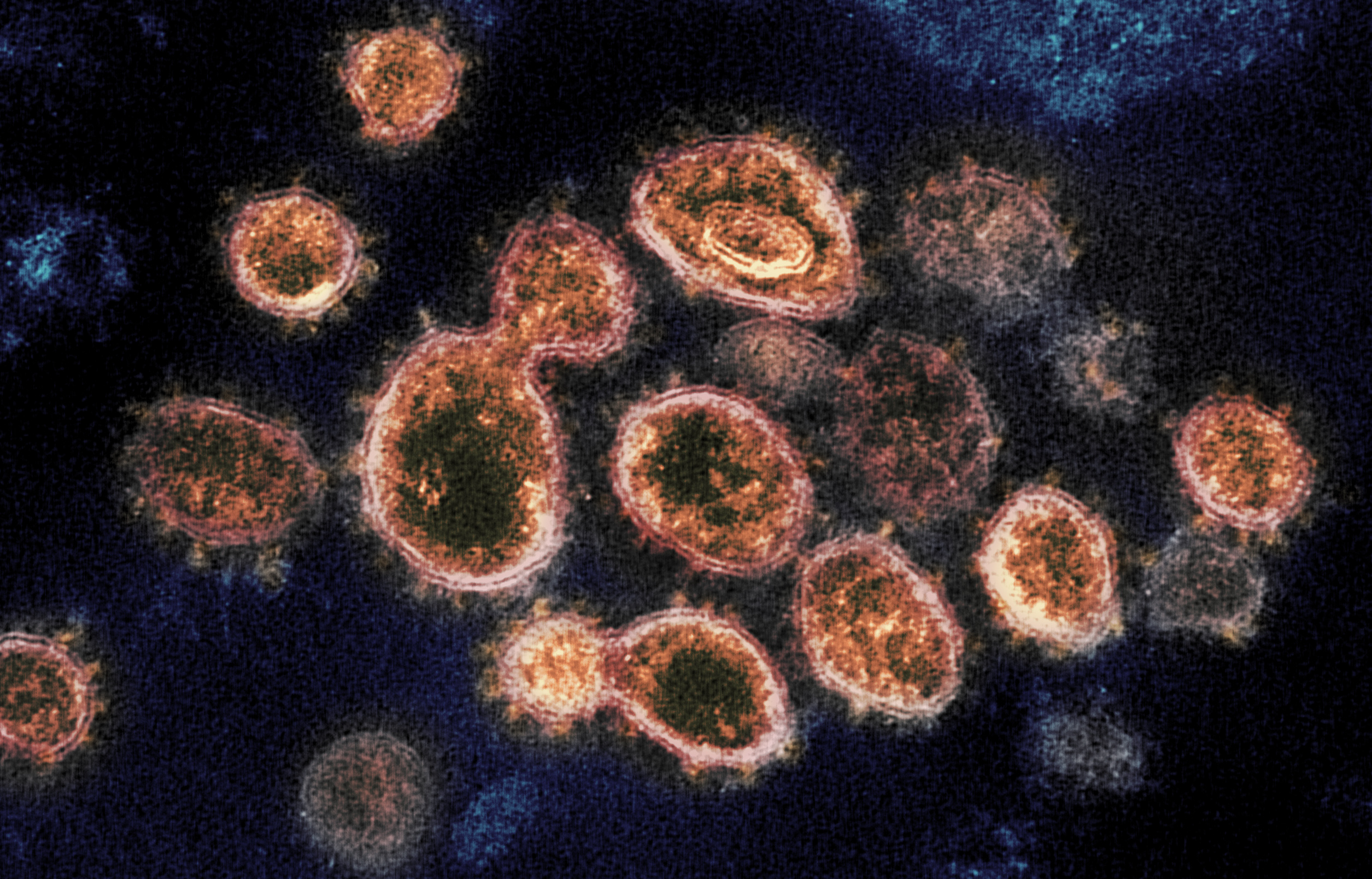 CoronaVirus Image by NIAID Public Domain