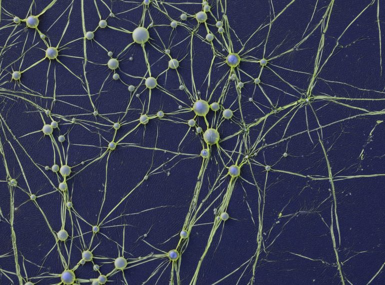 Microscopic view of neuron-like cells with green web-like connections on a dark blue background.
